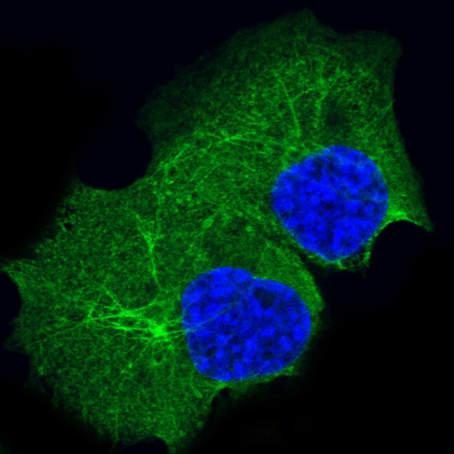 Cytokeratin 14 Antibody in Immunocytochemistry (ICC/IF)