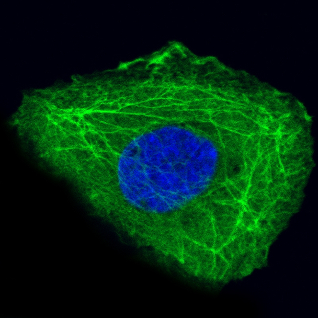 Cytokeratin 14 Antibody in Immunocytochemistry (ICC/IF)