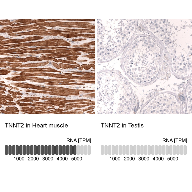 Cardiac Troponin T Antibody in Immunohistochemistry (Paraffin) (IHC (P))