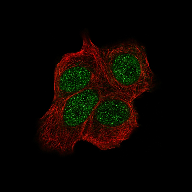 CHK2 Antibody in Immunocytochemistry (ICC/IF)