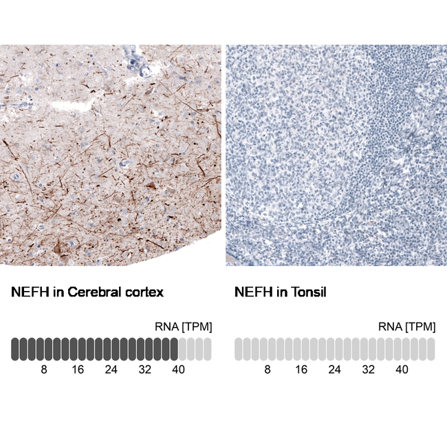 NF-H Antibody in Immunohistochemistry (Paraffin) (IHC (P))