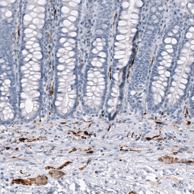 CRYAB Antibody in Immunohistochemistry (Paraffin) (IHC (P))