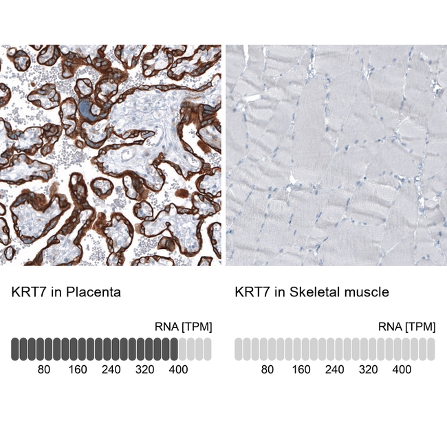 Cytokeratin 7 Antibody in Immunohistochemistry (Paraffin) (IHC (P))