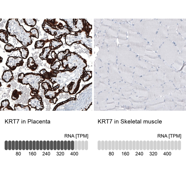 Cytokeratin 7 Antibody in Immunohistochemistry (Paraffin) (IHC (P))