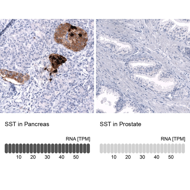Somatostatin Antibody in Immunohistochemistry (Paraffin) (IHC (P))