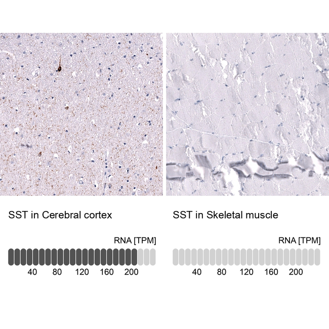 Somatostatin Antibody in Immunohistochemistry (Paraffin) (IHC (P))