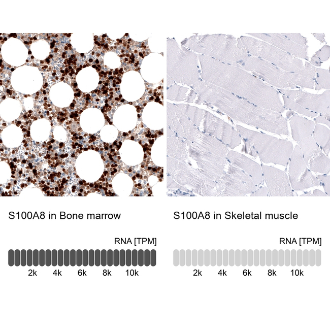 S100A8 Antibody in Immunohistochemistry (Paraffin) (IHC (P))