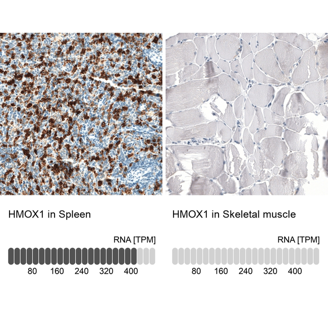 HO-1 Antibody in Immunohistochemistry (Paraffin) (IHC (P))