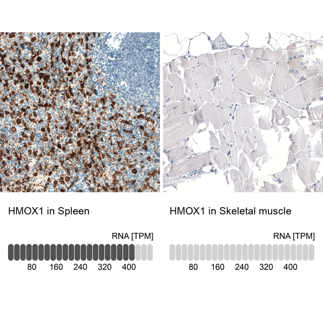 HO-1 Antibody in Immunohistochemistry (Paraffin) (IHC (P))