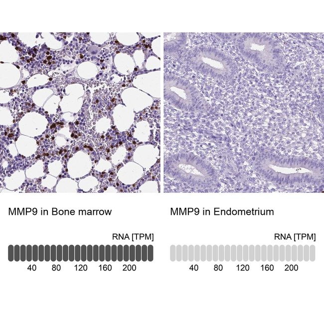 MMP9 Antibody in Immunohistochemistry (Paraffin) (IHC (P))