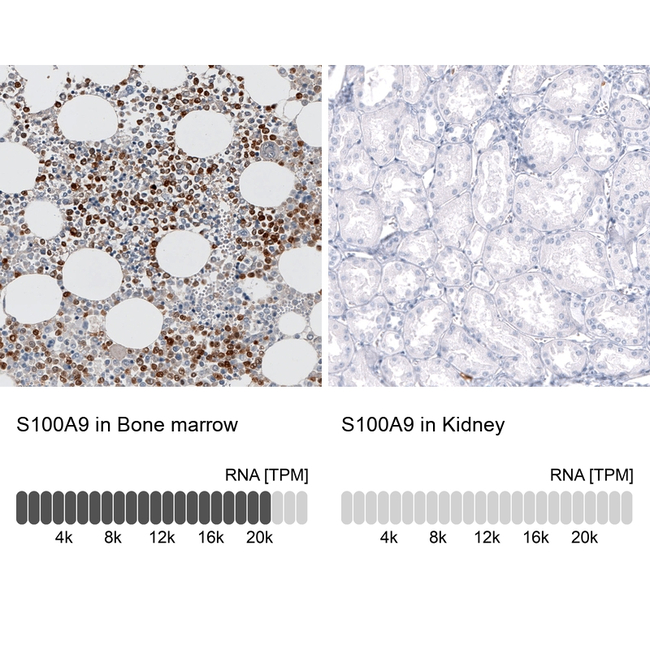 S100A9 Antibody in Immunohistochemistry (Paraffin) (IHC (P))