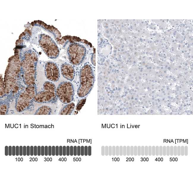 MUC1 Antibody in Immunohistochemistry (Paraffin) (IHC (P))