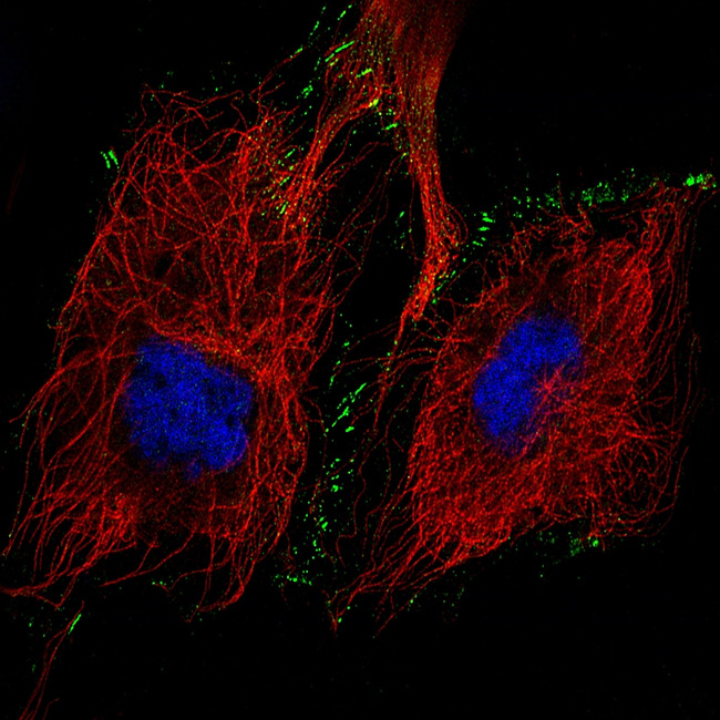 N-cadherin Antibody in Immunocytochemistry (ICC/IF)