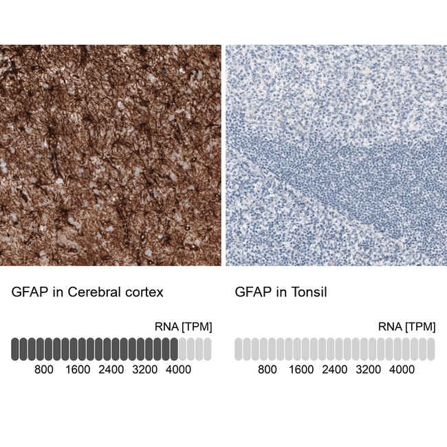 GFAP Antibody in Immunohistochemistry (Paraffin) (IHC (P))