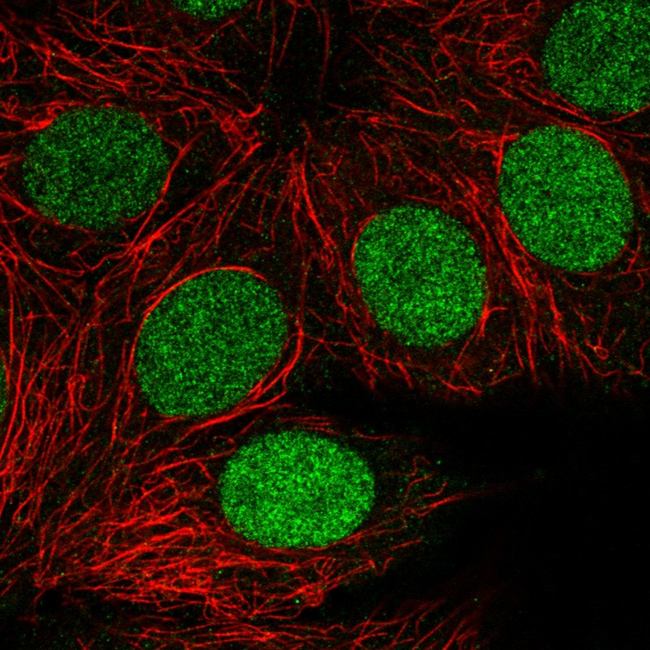 PARP1 Antibody in Immunocytochemistry (ICC/IF)
