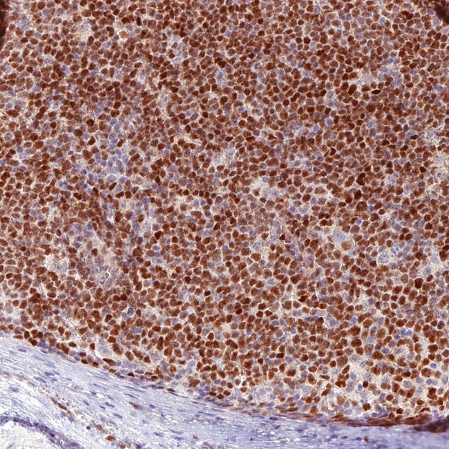SOX11 Antibody in Immunohistochemistry (Paraffin) (IHC (P))