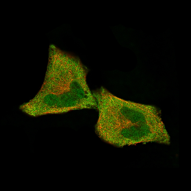 CDK4 Antibody in Immunocytochemistry (ICC/IF)