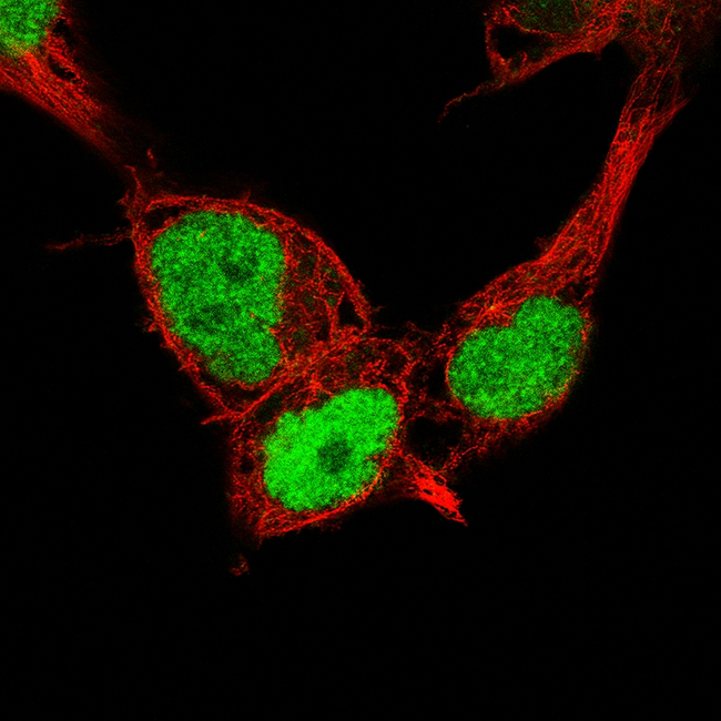 Nanog Antibody in Immunocytochemistry (ICC/IF)