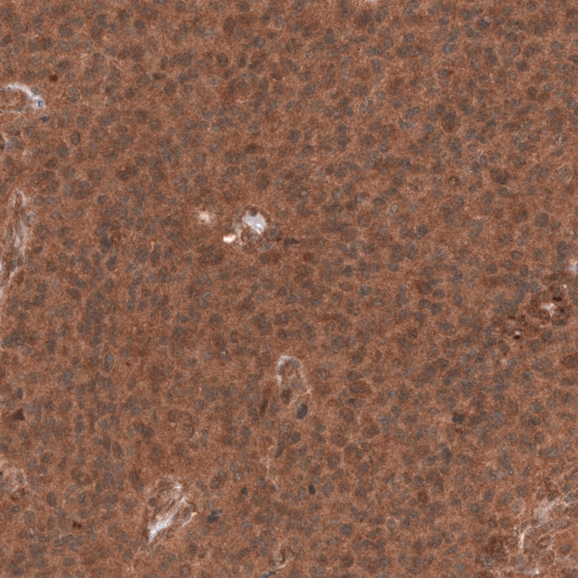 YAP1 Antibody in Immunohistochemistry (Paraffin) (IHC (P))