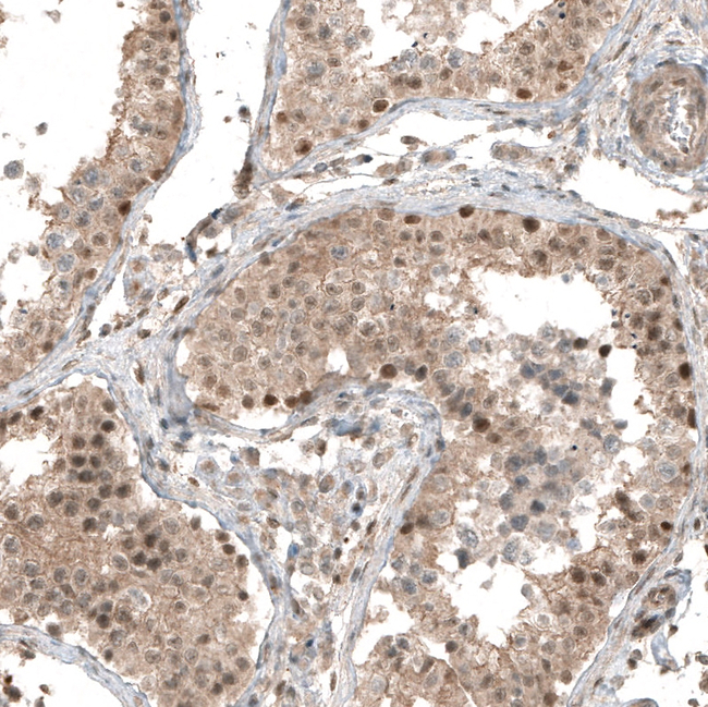 SMAD4 Antibody in Immunohistochemistry (Paraffin) (IHC (P))