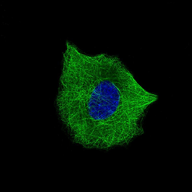 Beta III Tubulin Antibody in Immunocytochemistry (ICC/IF)