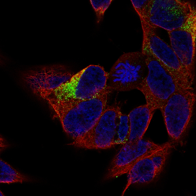 MAP2 Antibody in Immunocytochemistry (ICC/IF)