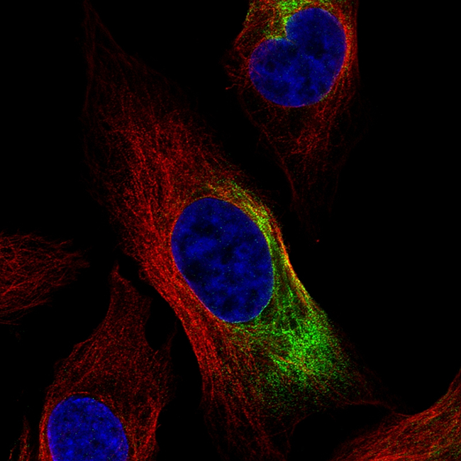 NEFL Antibody in Immunocytochemistry (ICC/IF)