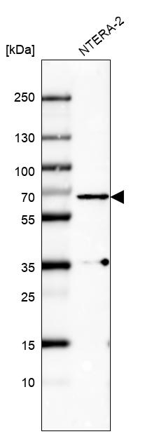 PLK1 Antibody in Western Blot (WB)