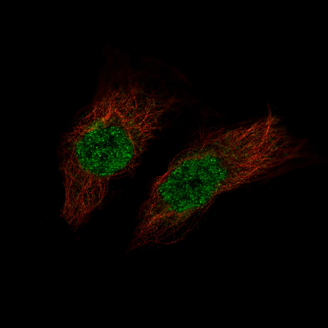 PAX8 Antibody in Immunocytochemistry (ICC/IF)
