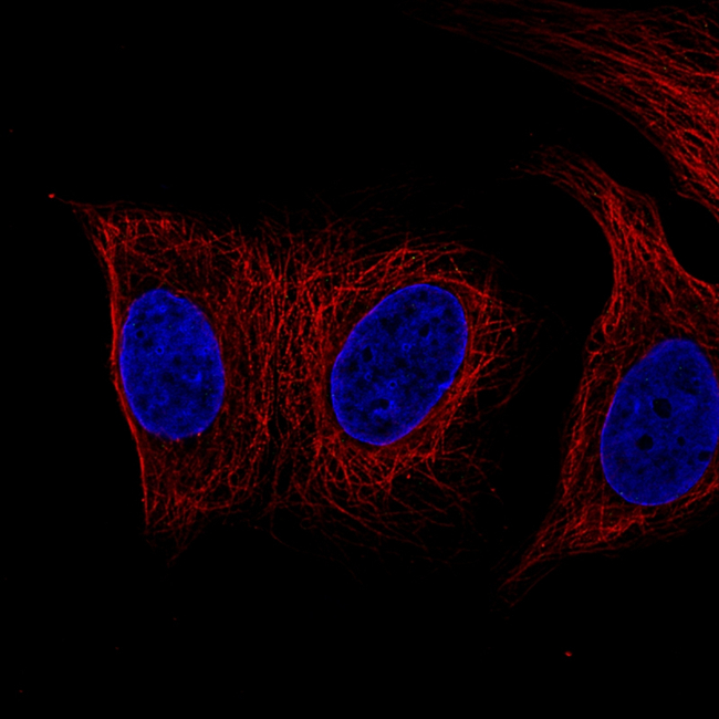 Desmin Antibody in Immunocytochemistry (ICC/IF)