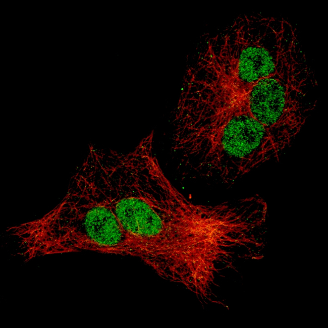 p21 Antibody in Immunocytochemistry (ICC/IF)