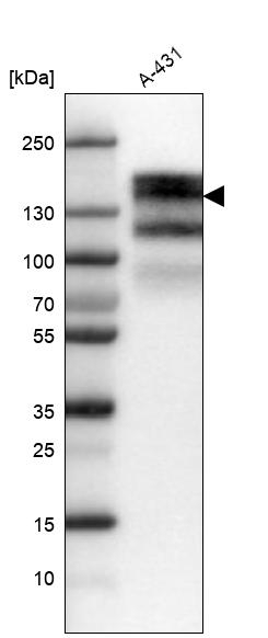 EGFR Antibody in Western Blot (WB)