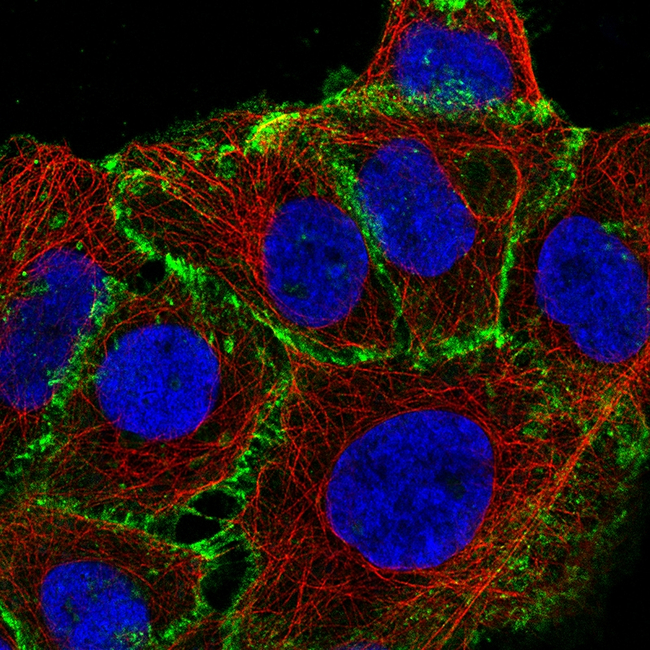 beta Catenin Antibody in Immunocytochemistry (ICC/IF)