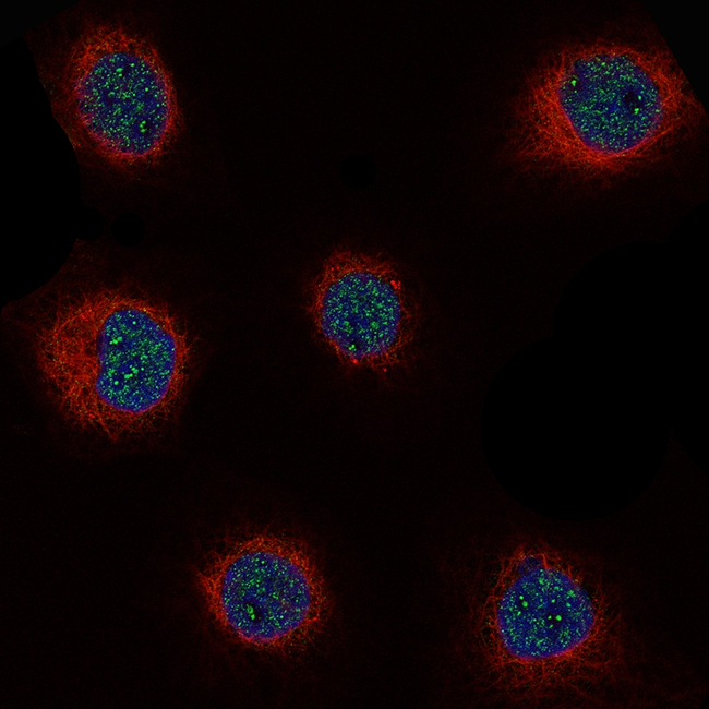 Cyclin D1 Antibody in Immunocytochemistry (ICC/IF)