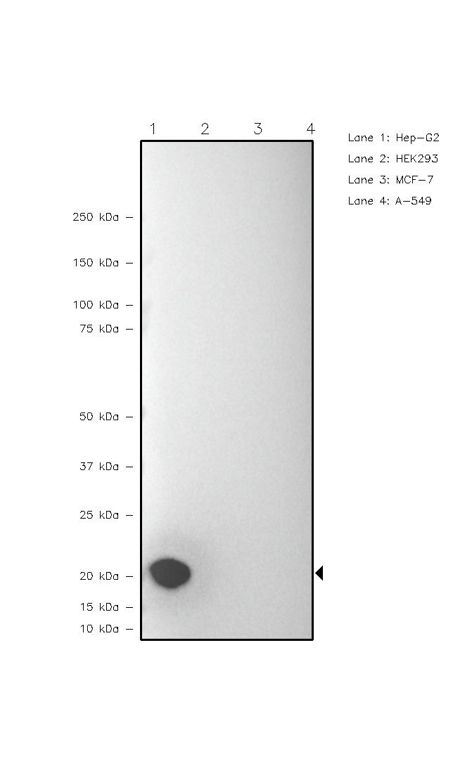 VSNL1 Antibody in Western Blot (WB)