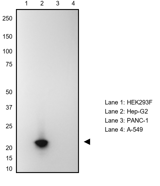 VSNL1 Antibody in Western Blot (WB)