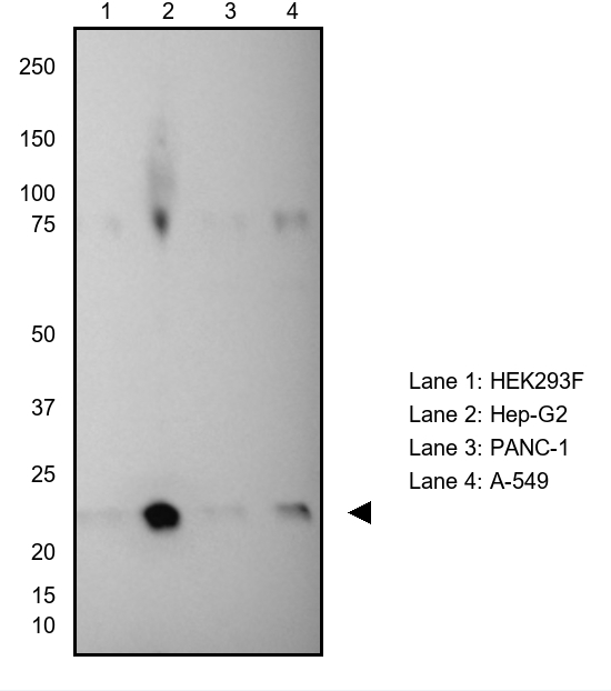 VSNL1 Antibody in Western Blot (WB)