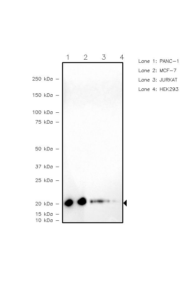 VPS72 Antibody in Western Blot (WB)