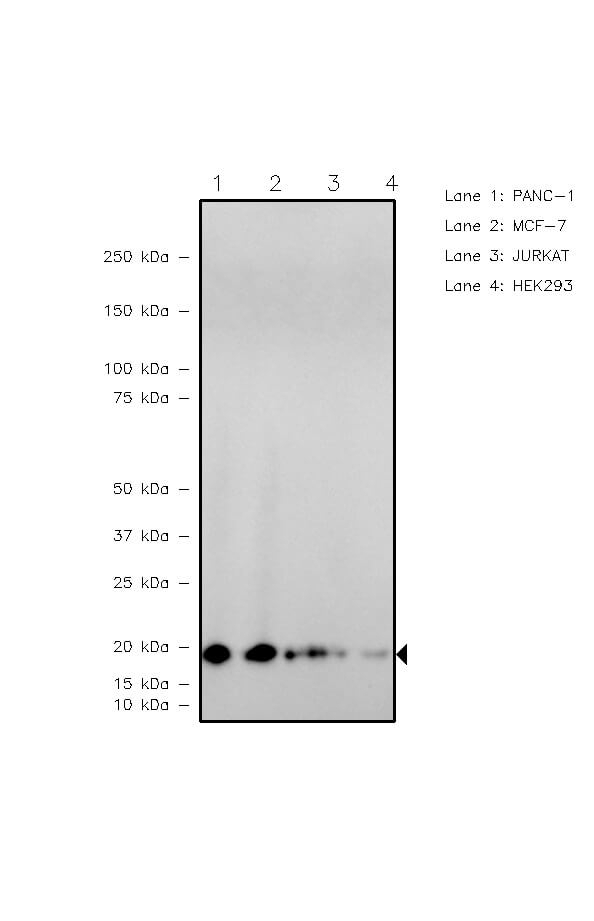 VPS72 Antibody in Western Blot (WB)