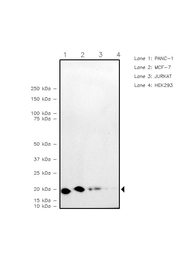 VPS72 Antibody in Western Blot (WB)
