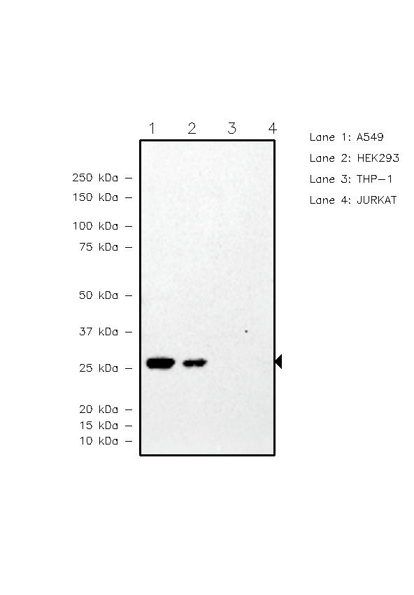 TPI1 Antibody in Western Blot (WB)