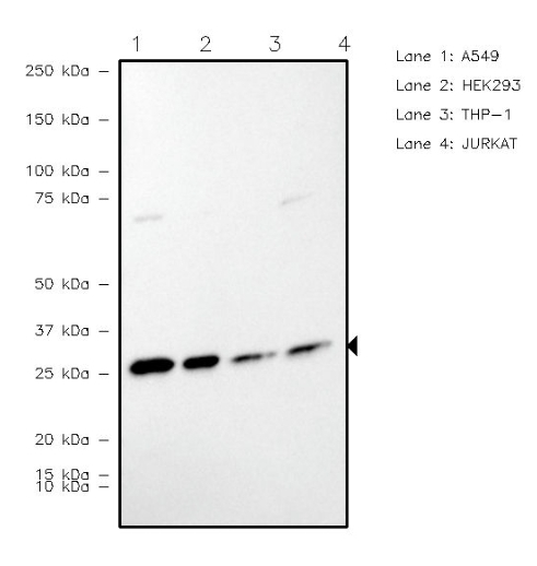 TPI1 Antibody in Western Blot (WB)
