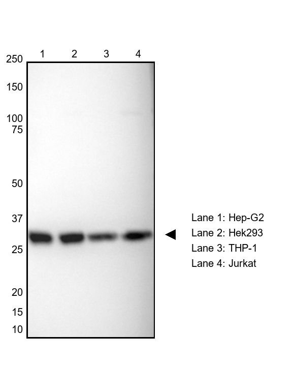 TPI1 Antibody in Western Blot (WB)