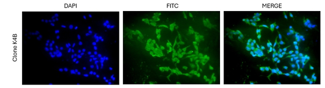HSP40 Antibody in Immunocytochemistry (ICC/IF)
