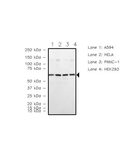 DDR2 Antibody in Western Blot (WB)