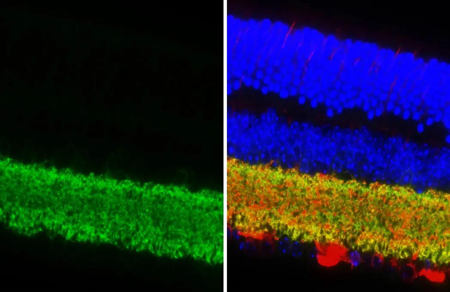 GAT-1 Antibody in Immunohistochemistry (Paraffin) (IHC (P))