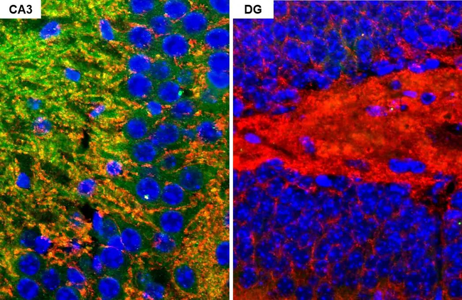 GluR2 Antibody in Immunohistochemistry (Paraffin) (IHC (P))
