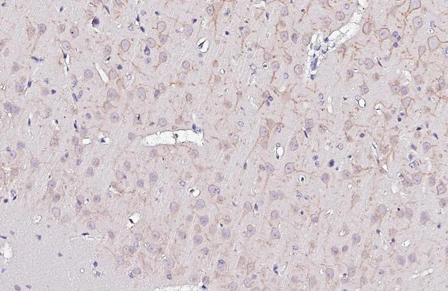 KCNB1 Antibody in Immunohistochemistry (Paraffin) (IHC (P))