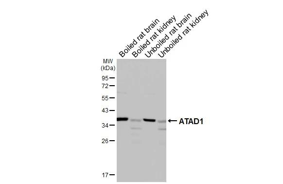 ATAD1 Antibody in Western Blot (WB)