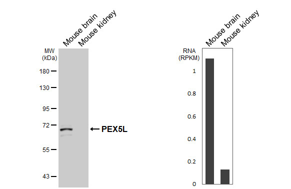 PEX5L Antibody in Western Blot (WB)